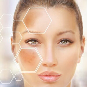 DARK MARKS / PIGMENTATION