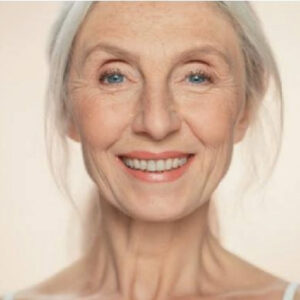 MATURE / SUN DAMAGED